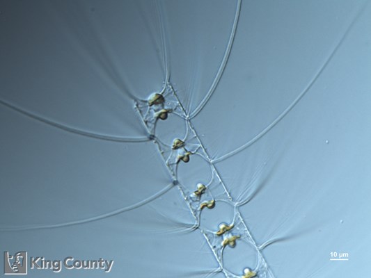 Photo of Chaetoceros didymus